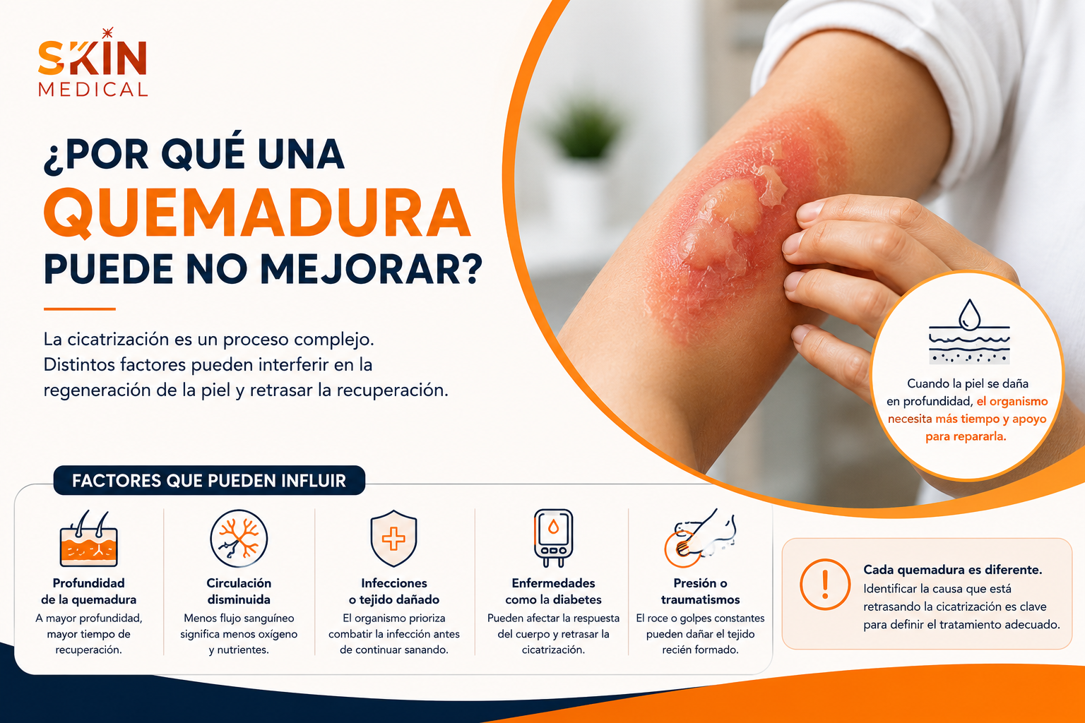 ¿Por qué una quemadura puede no mejorar?
