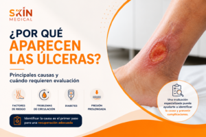 ¿Por qué aparecen las úlceras? Principales causas y cuándo requieren evaluación