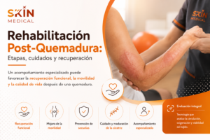 Rehabilitación Post-Quemadura: Etapas, cuidados y recuperación