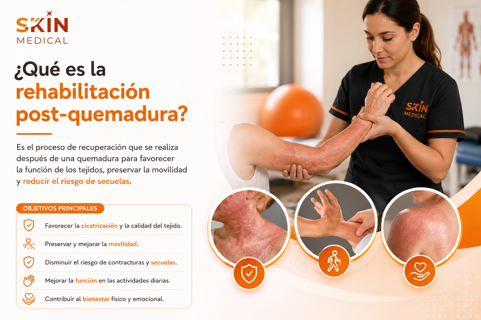 ¿Qué es la rehabilitación post-quemadura?