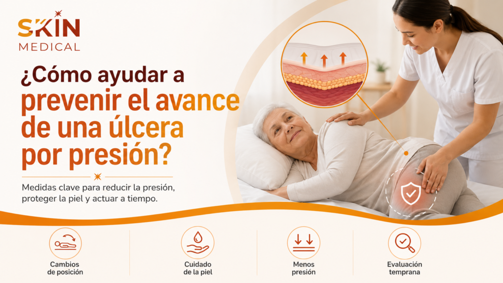 ¿Cómo ayudar a prevenir el avance de una úlcera por presión?