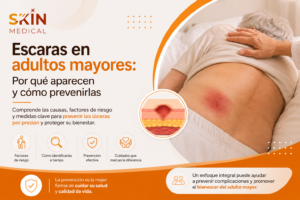 Escaras en adultos mayores: Por qué aparecen y cómo prevenirlas