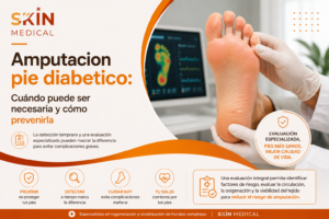 Amputacion pie diabetico: Cuándo puede ser necesaria y cómo prevenirla