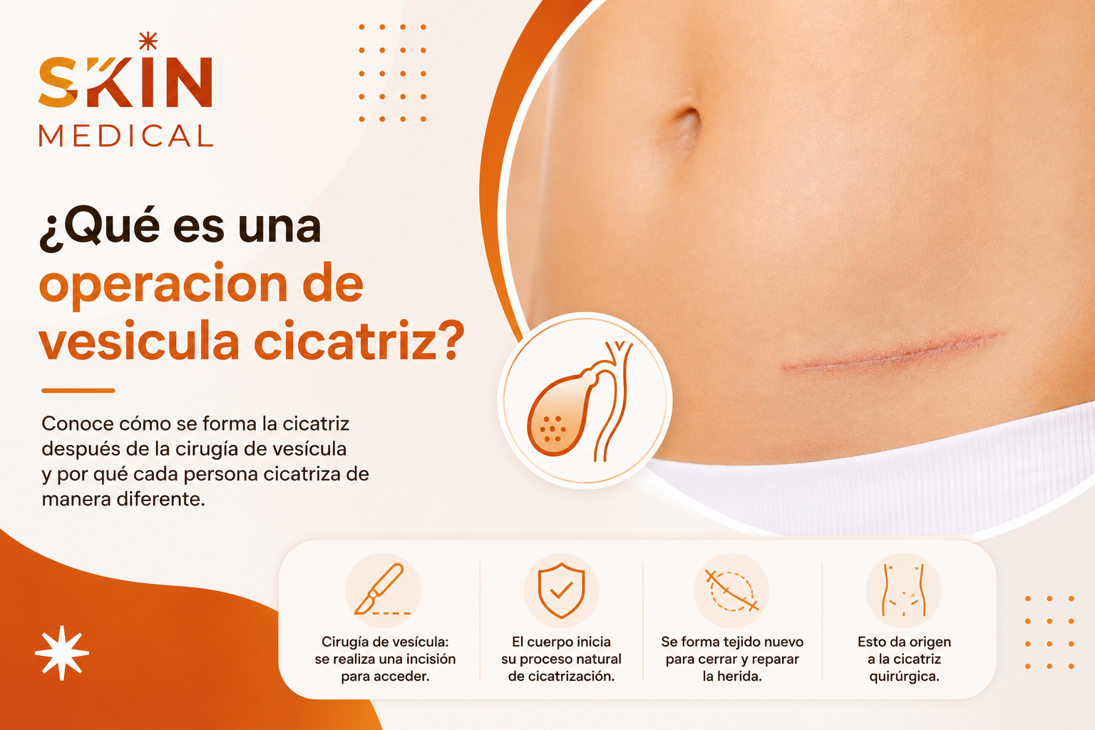 ¿Qué es una operacion de vesicula cicatriz?