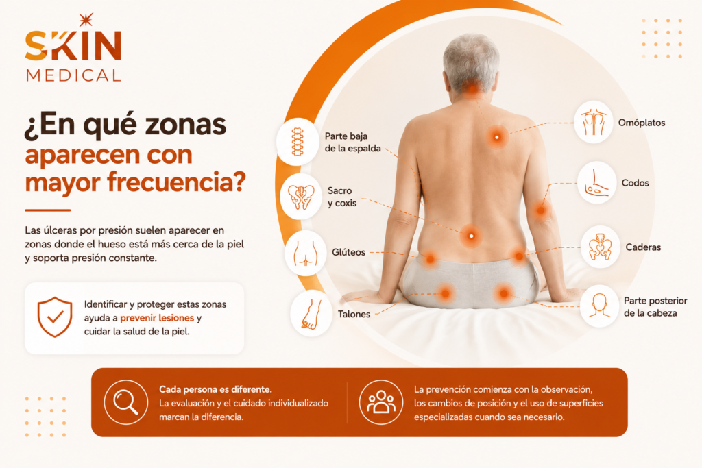 ¿En qué zonas aparecen con mayor frecuencia?