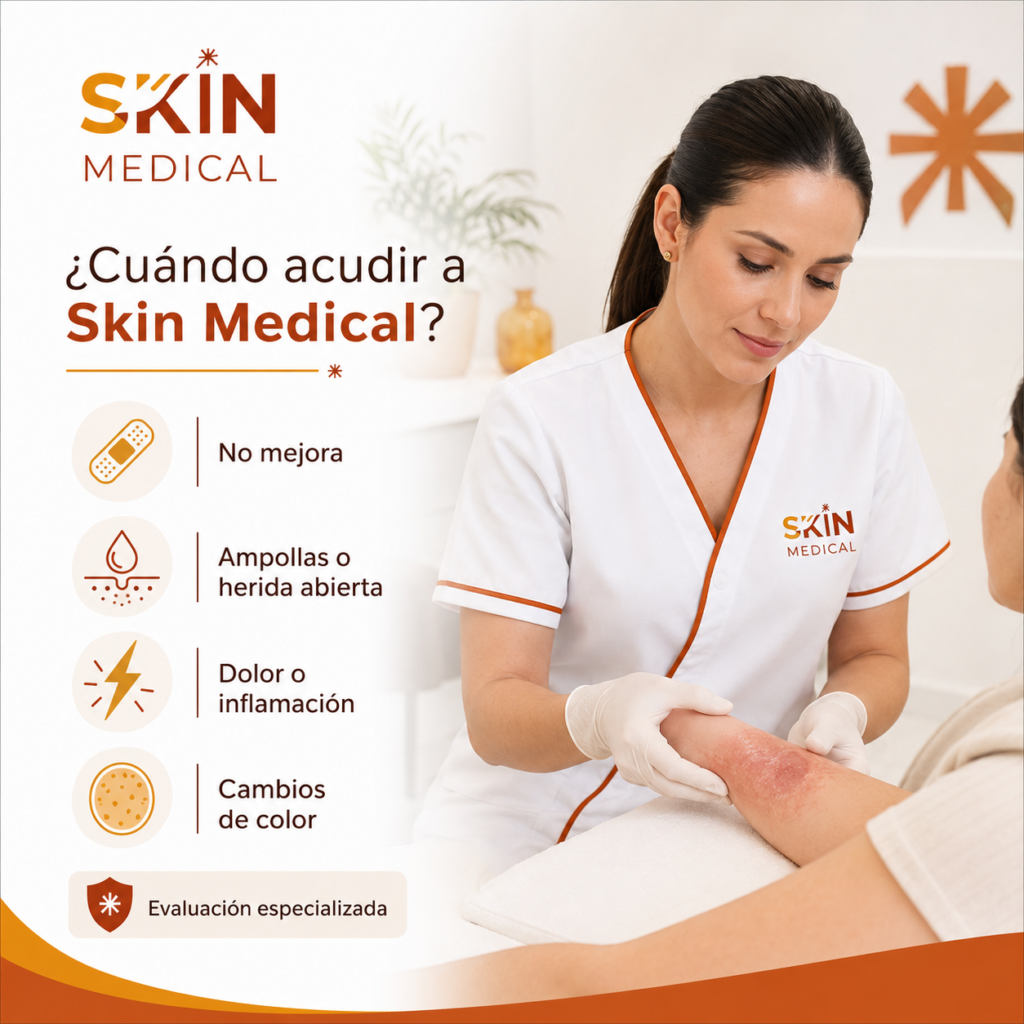 ¿Cuándo acudir a Skin Medical?​