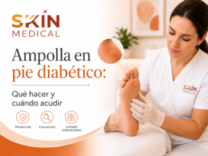 Ampolla en pie diabético: Qué hacer y cuándo acudir