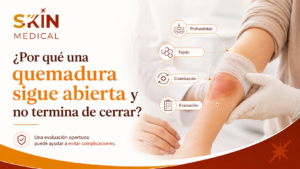 ¿Por qué una quemadura sigue abierta y no termina de cerrar?