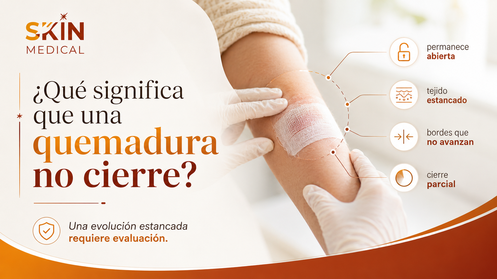 ¿Qué significa que una quemadura no cierre?