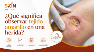 ¿Qué significa observar tejido amarillo en una herida?