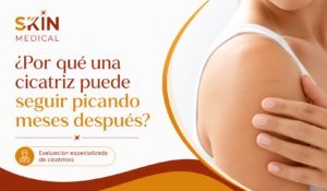 ¿Por qué una cicatriz puede seguir picando meses después?