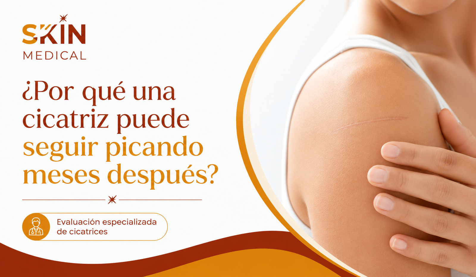¿Por qué una cicatriz puede seguir picando meses después?