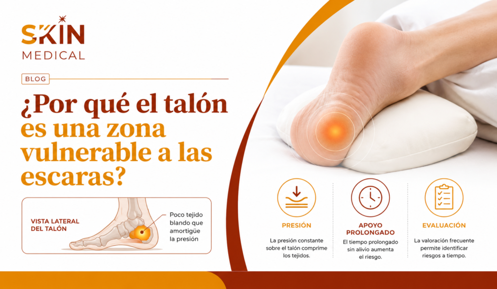 ¿Por qué el talón es una zona vulnerable a las escaras?​