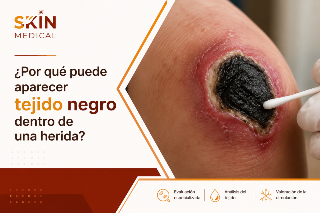 ¿Por qué puede aparecer tejido negro dentro de una herida?