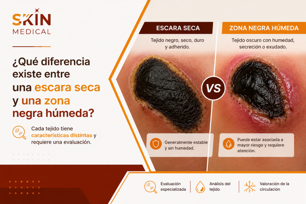 ¿Qué diferencia existe entre una escara seca y una zona negra húmeda?