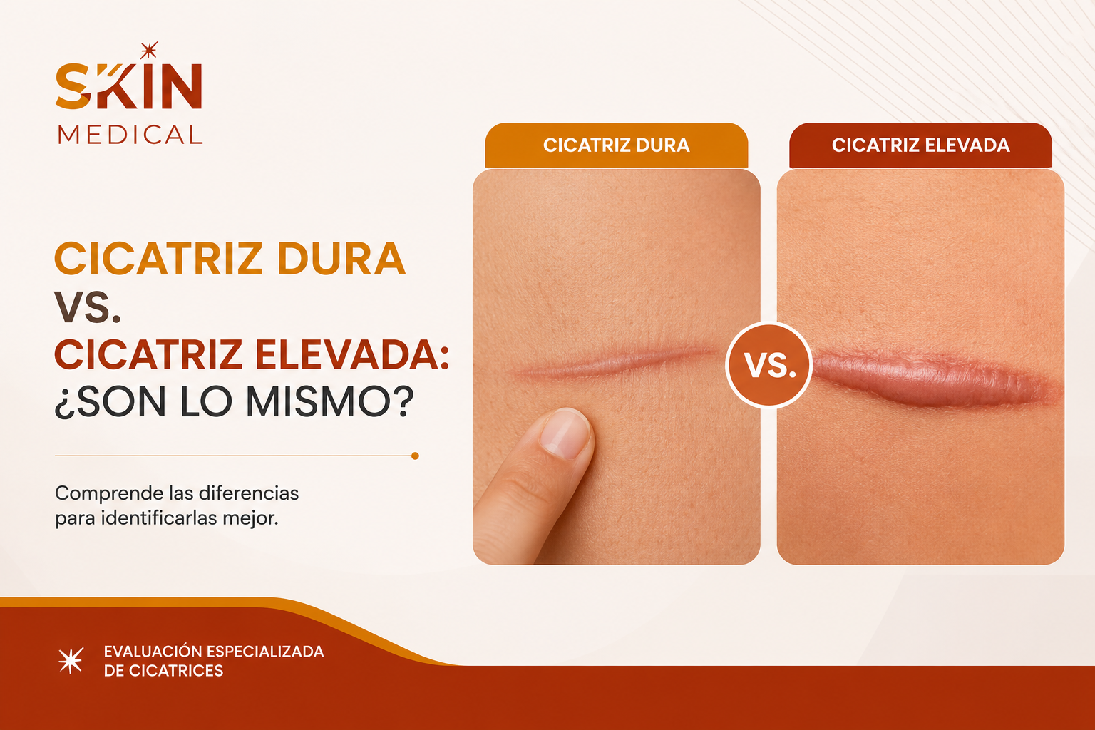 Cicatriz dura vs. cicatriz elevada: ¿son lo mismo?​