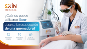 ¿Cuándo puede utilizarse láser durante la recuperación de una quemadura?
