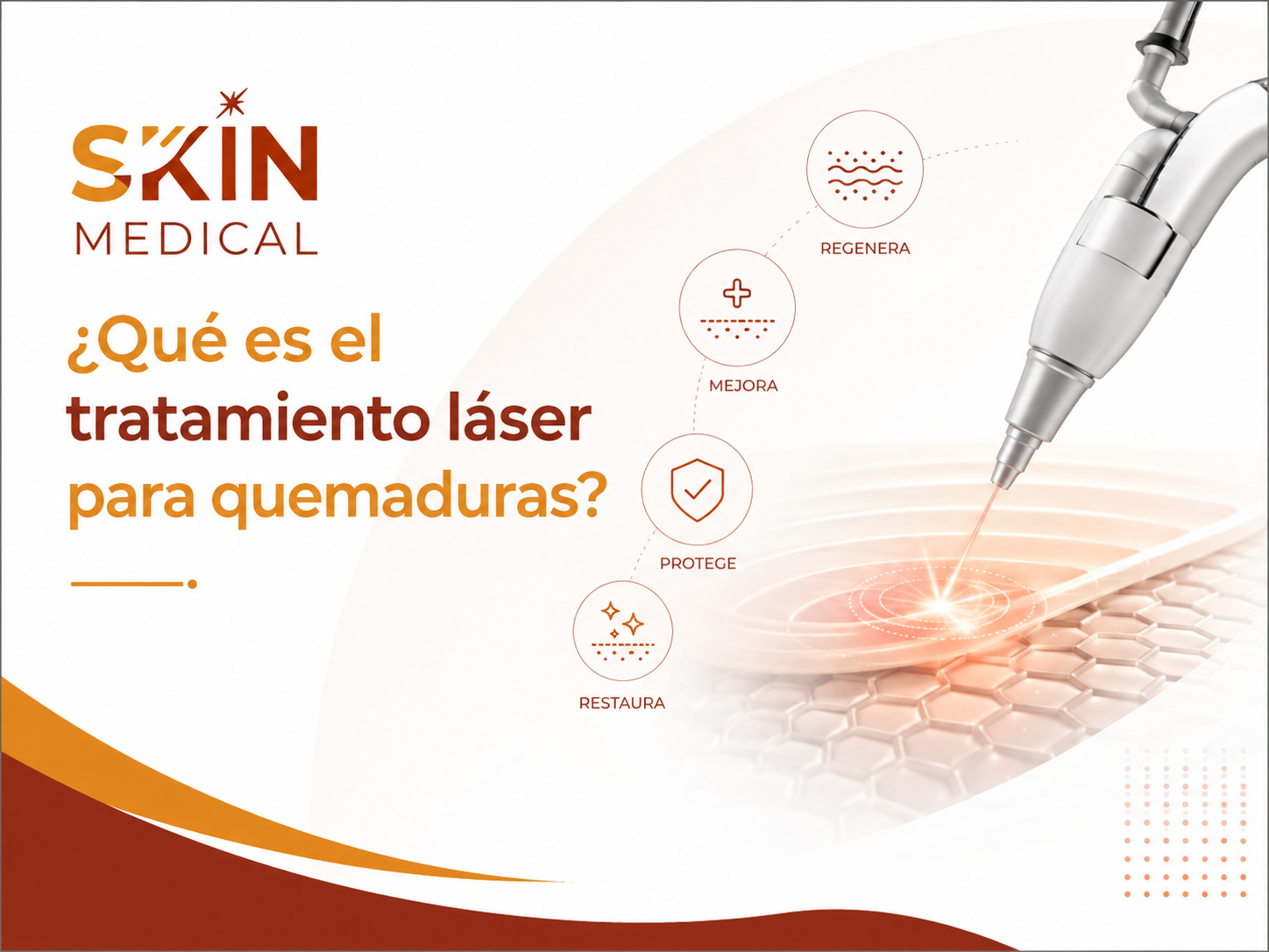 ¿Qué es el tratamiento láser para quemaduras?​