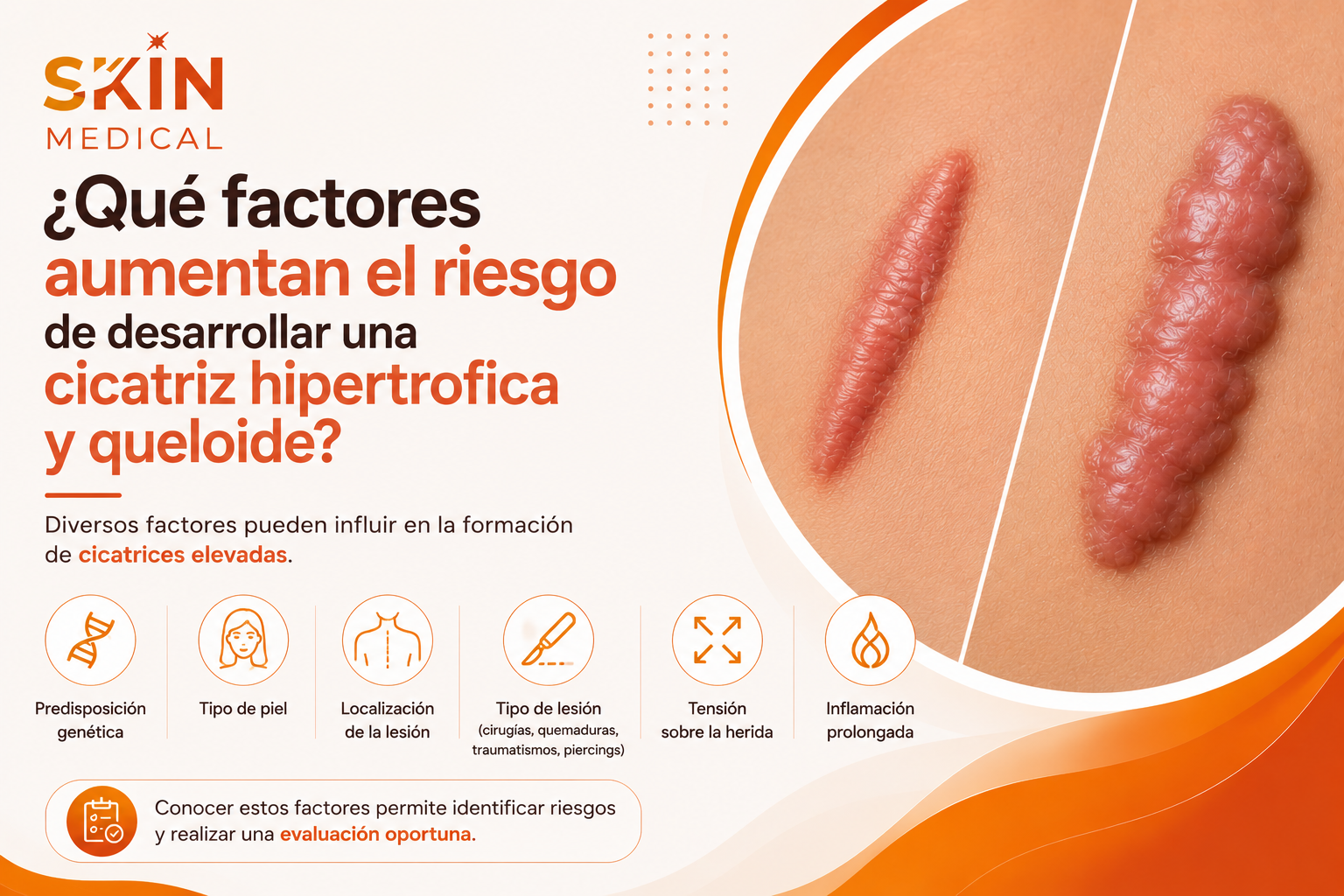 ¿Qué factores aumentan el riesgo de desarrollar una cicatriz hipertrofica y queloide?​