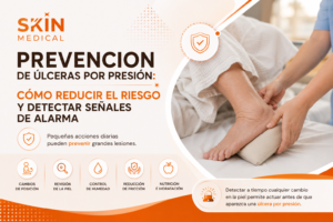 Prevencion de ulceras por presion: Cómo reducir el riesgo y detectar señales de alarma
