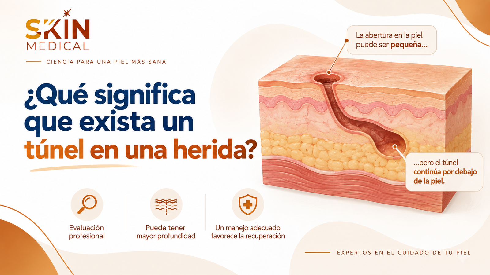 ¿Qué significa que exista un túnel en una herida?​