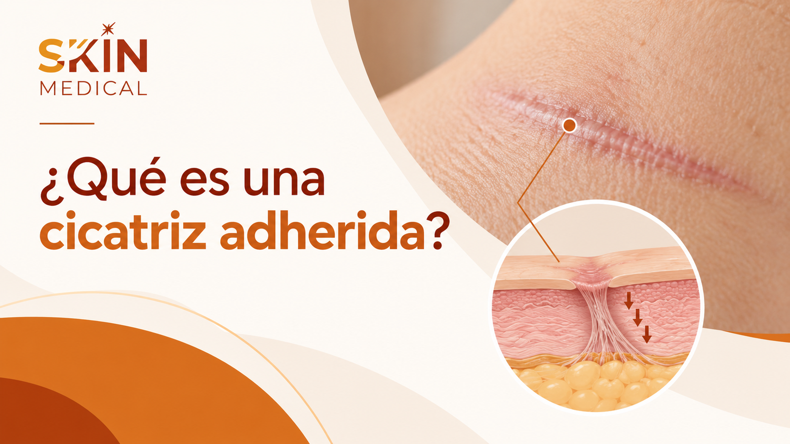 ¿Qué es una cicatriz adherida?