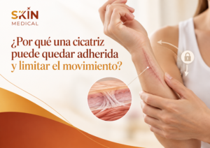 ¿Por qué una cicatriz puede quedar adherida y limitar el movimiento?