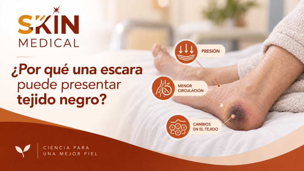 ¿Por qué una escara puede presentar tejido negro?