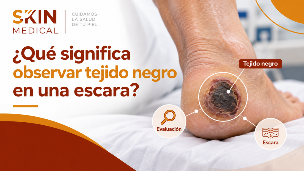 ¿Qué significa observar tejido negro en una escara?