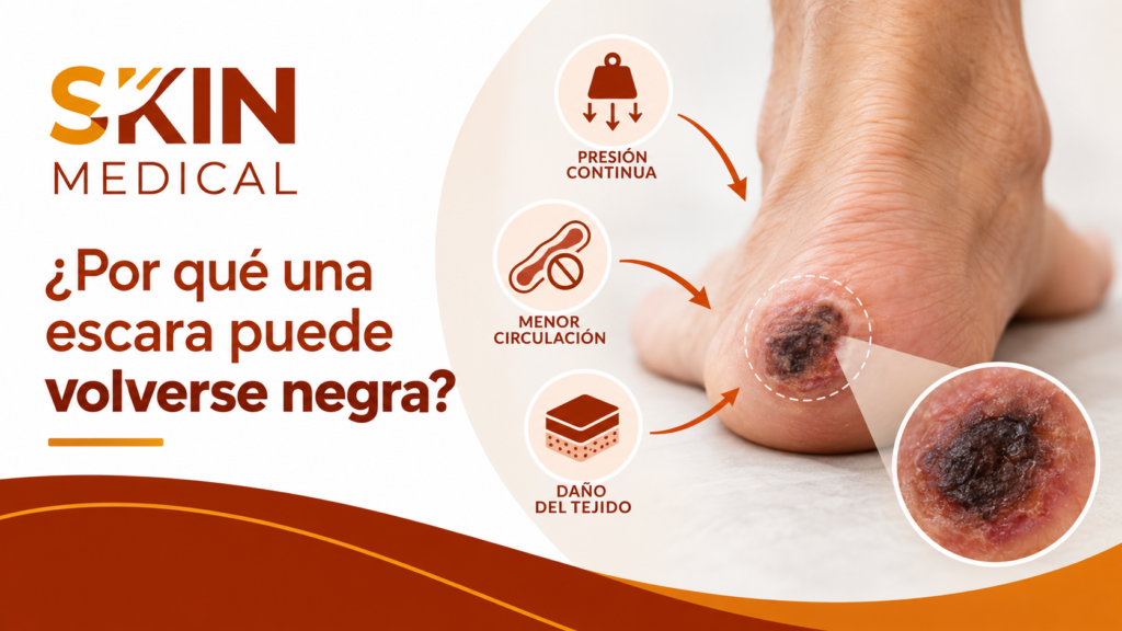 ¿Por qué una escara puede volverse negra?