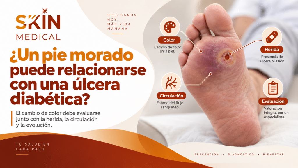 ¿Un pie morado puede relacionarse con una úlcera diabética?