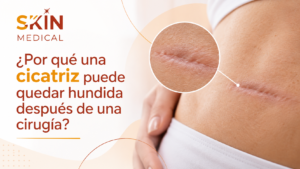 ¿Por qué una cicatriz puede quedar hundida después de una cirugía?