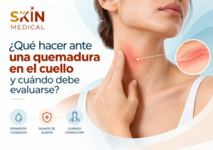 ¿Qué hacer ante una quemadura en el cuello y cuándo debe evaluarse?