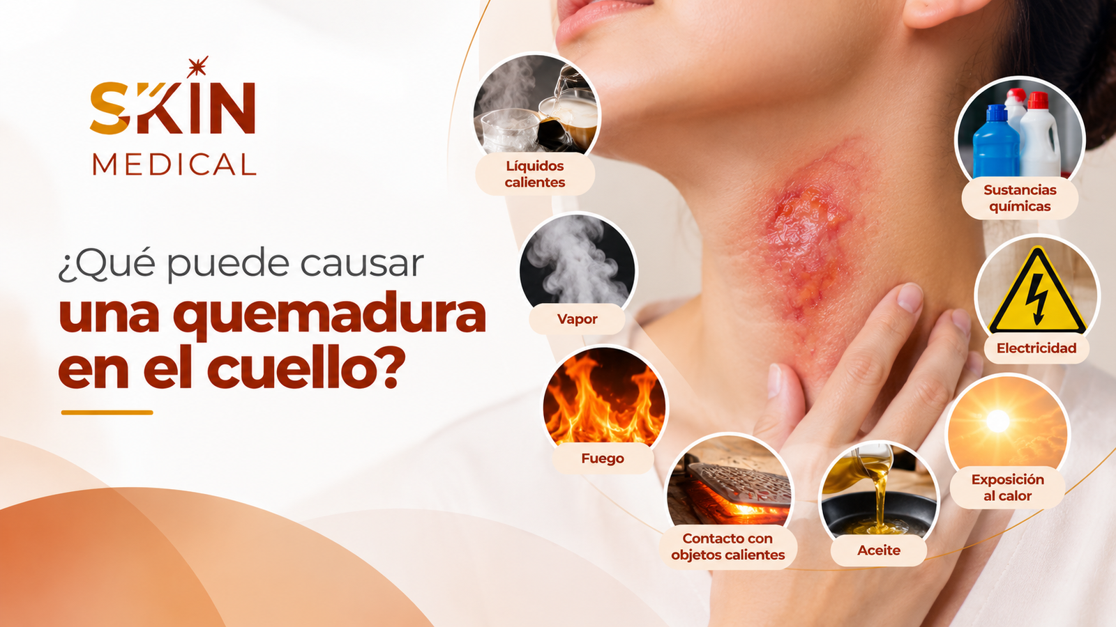 ¿Qué puede causar una quemadura en el cuello?