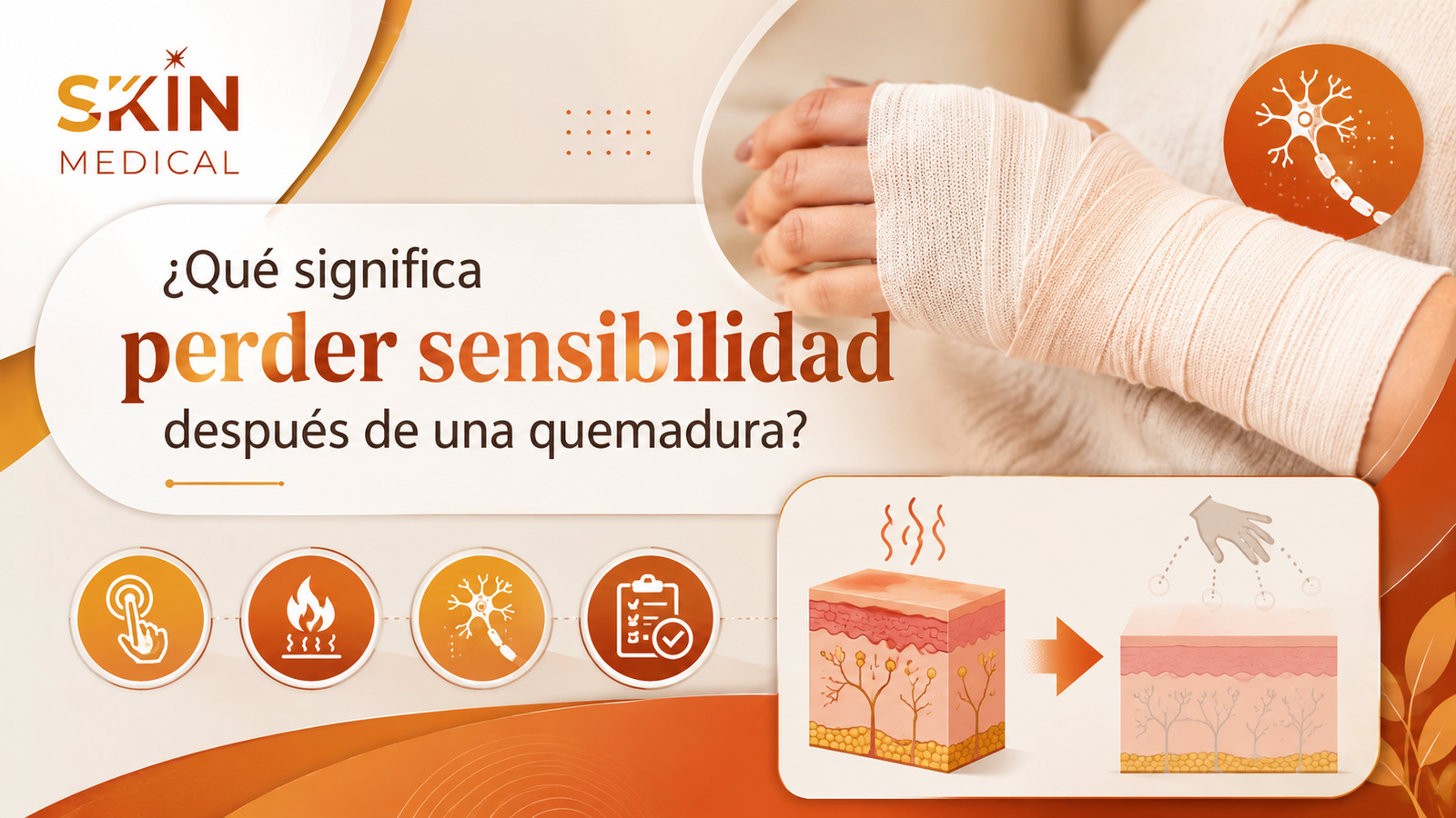 ¿Qué significa perder sensibilidad después de una quemadura?
