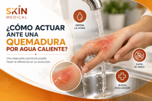 ¿Cómo actuar ante una quemadura por agua caliente?