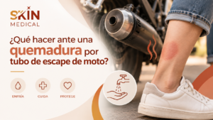 ¿Qué hacer ante una quemadura por tubo de escape de moto?