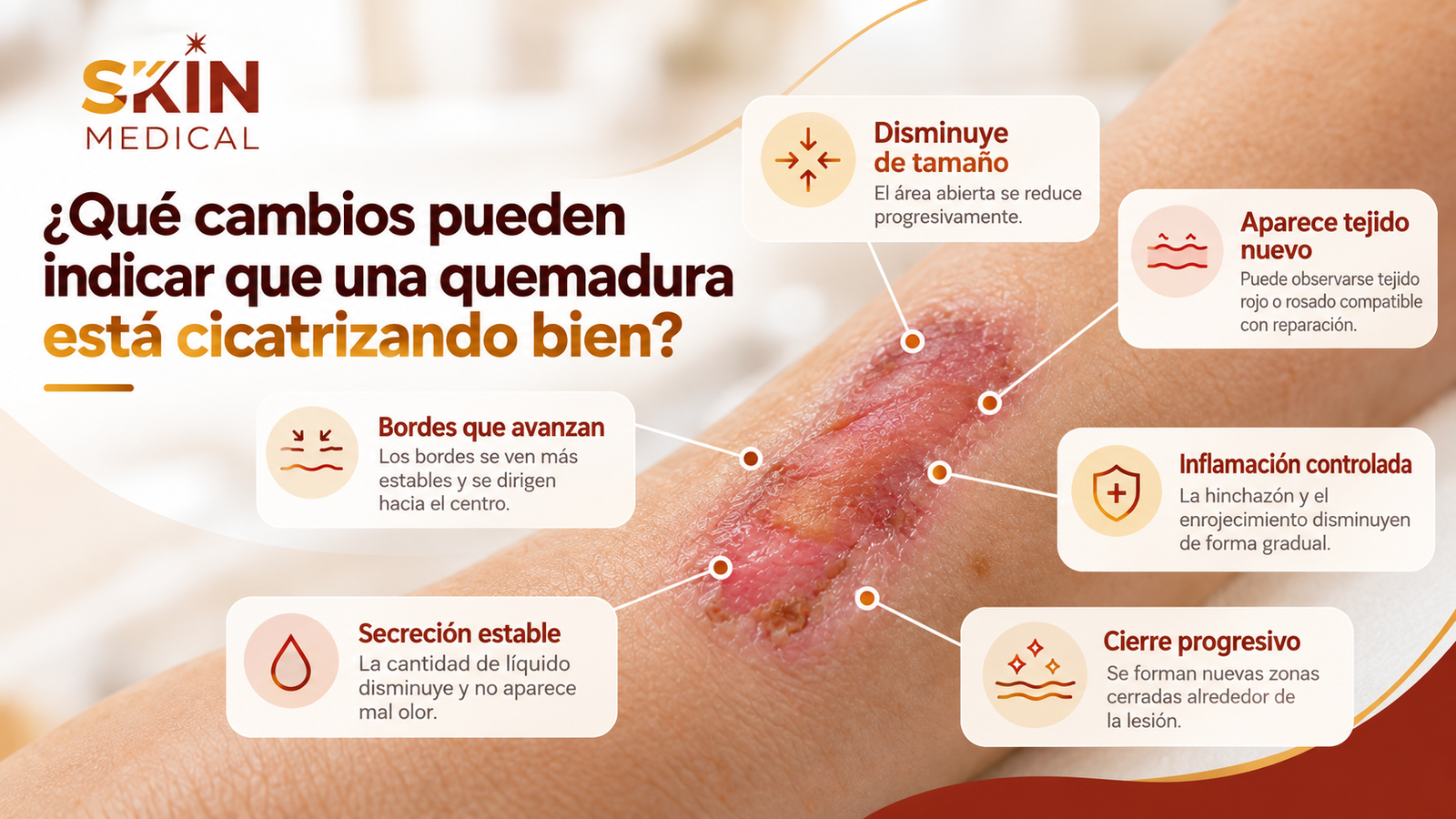 ¿Qué cambios pueden indicar que una quemadura está cicatrizando bien?