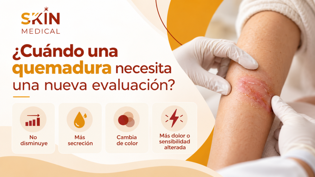 ¿Cuándo una quemadura necesita una nueva evaluación?