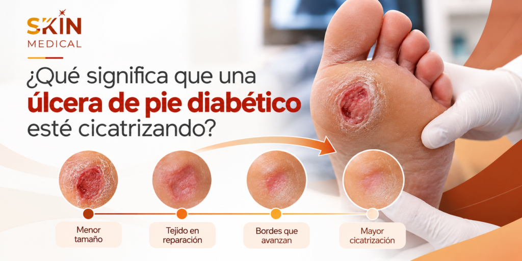 ¿Qué significa que una úlcera de pie diabético esté cicatrizando?