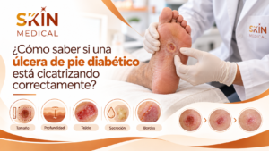 ¿Cómo saber si una úlcera de pie diabético está cicatrizando correctamente?