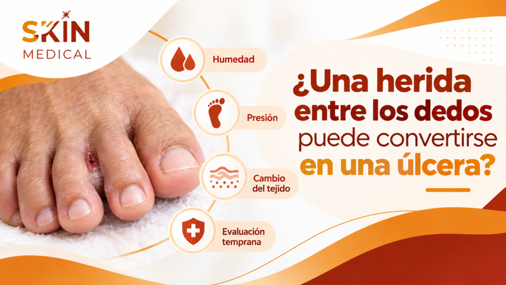 ¿Una herida entre los dedos puede convertirse en una úlcera?