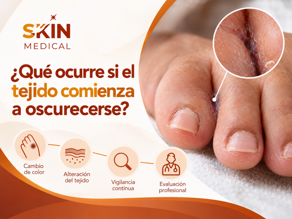 ¿Qué ocurre si el tejido comienza a oscurecerse?