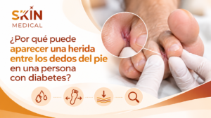 ¿Por qué puede aparecer una herida entre los dedos del pie en una persona con diabetes?
