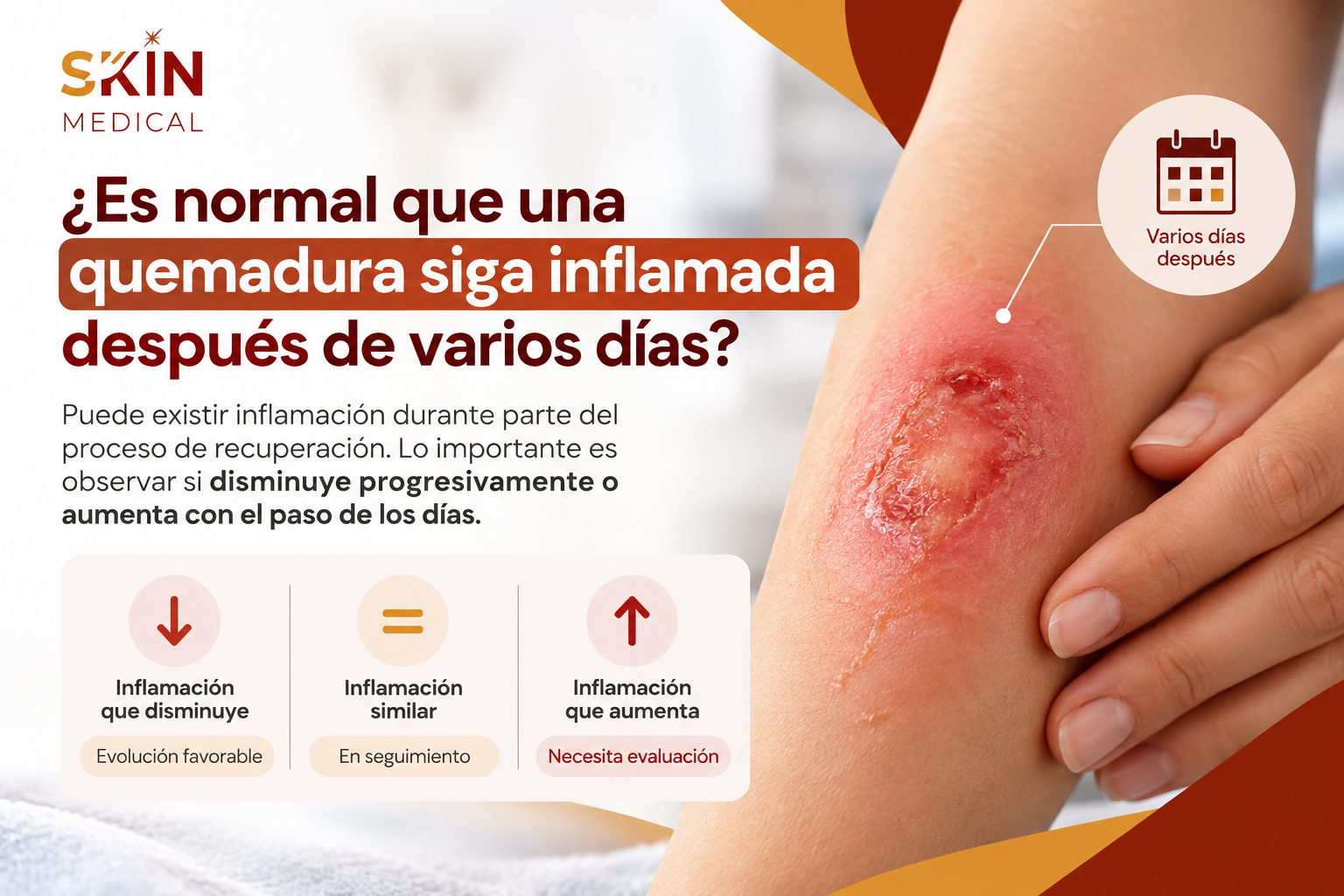 ¿Es normal que una quemadura siga inflamada después de varios días?