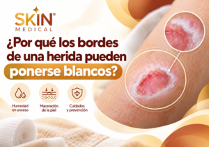 ¿Por qué los bordes de una herida pueden ponerse blancos?