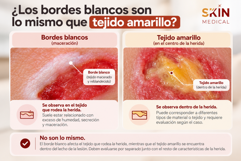 ¿Los bordes blancos son lo mismo que tejido amarillo?