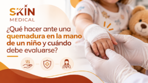 ¿Qué hacer ante una quemadura en la mano de un niño y cuándo debe evaluarse?
