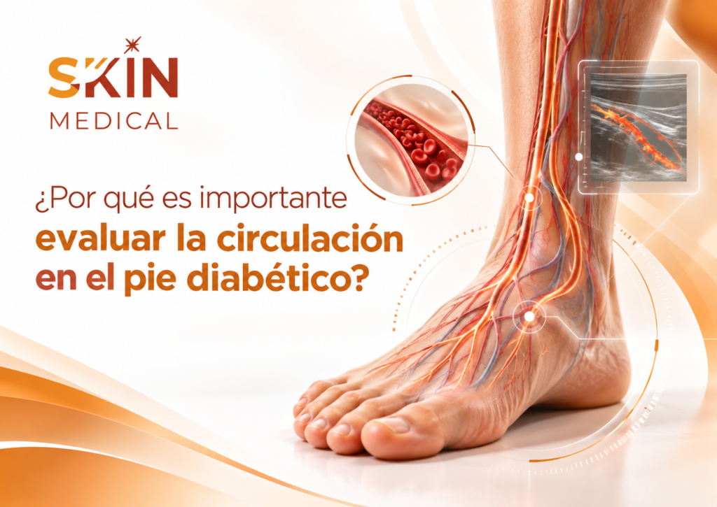 ¿Por qué es importante evaluar la circulación en el pie diabético?