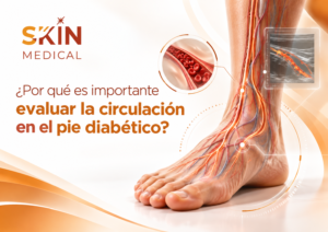 ¿Por qué es importante evaluar la circulación en el pie diabético?